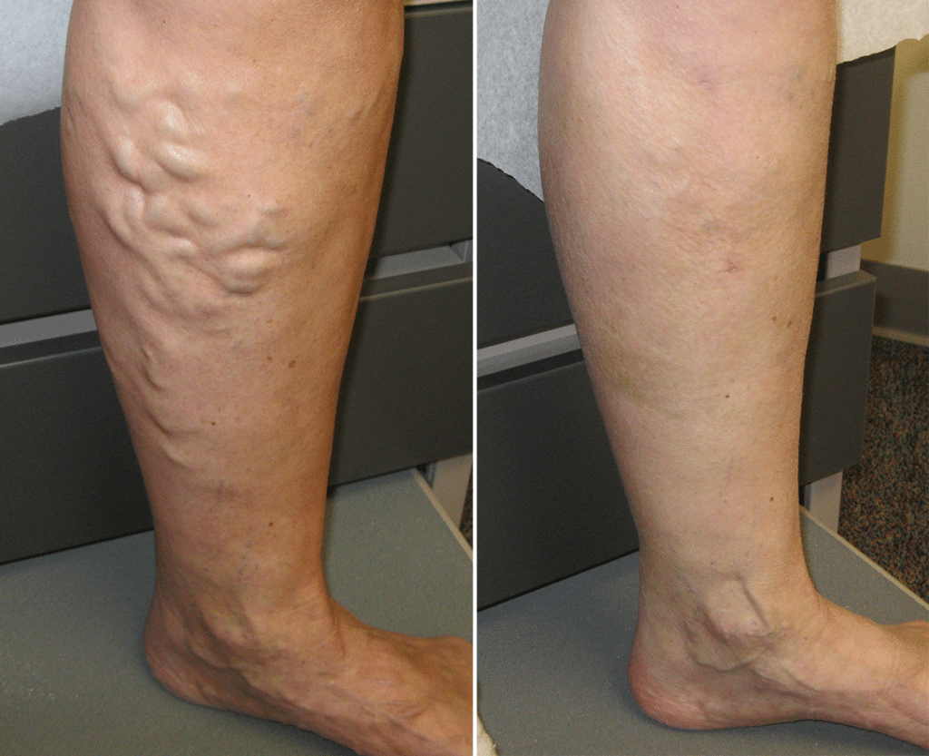 SmoothSpine™ Non-Slip Sleep Socks